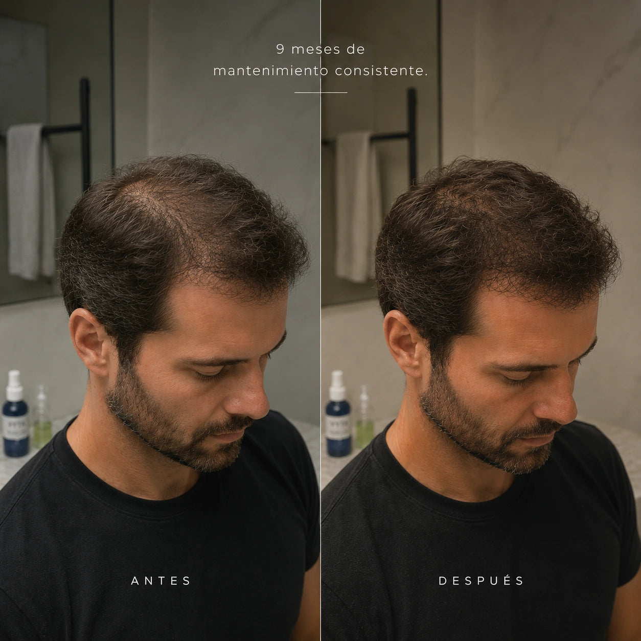 VYTA - RECUPERA TU CABELLO EN CASA