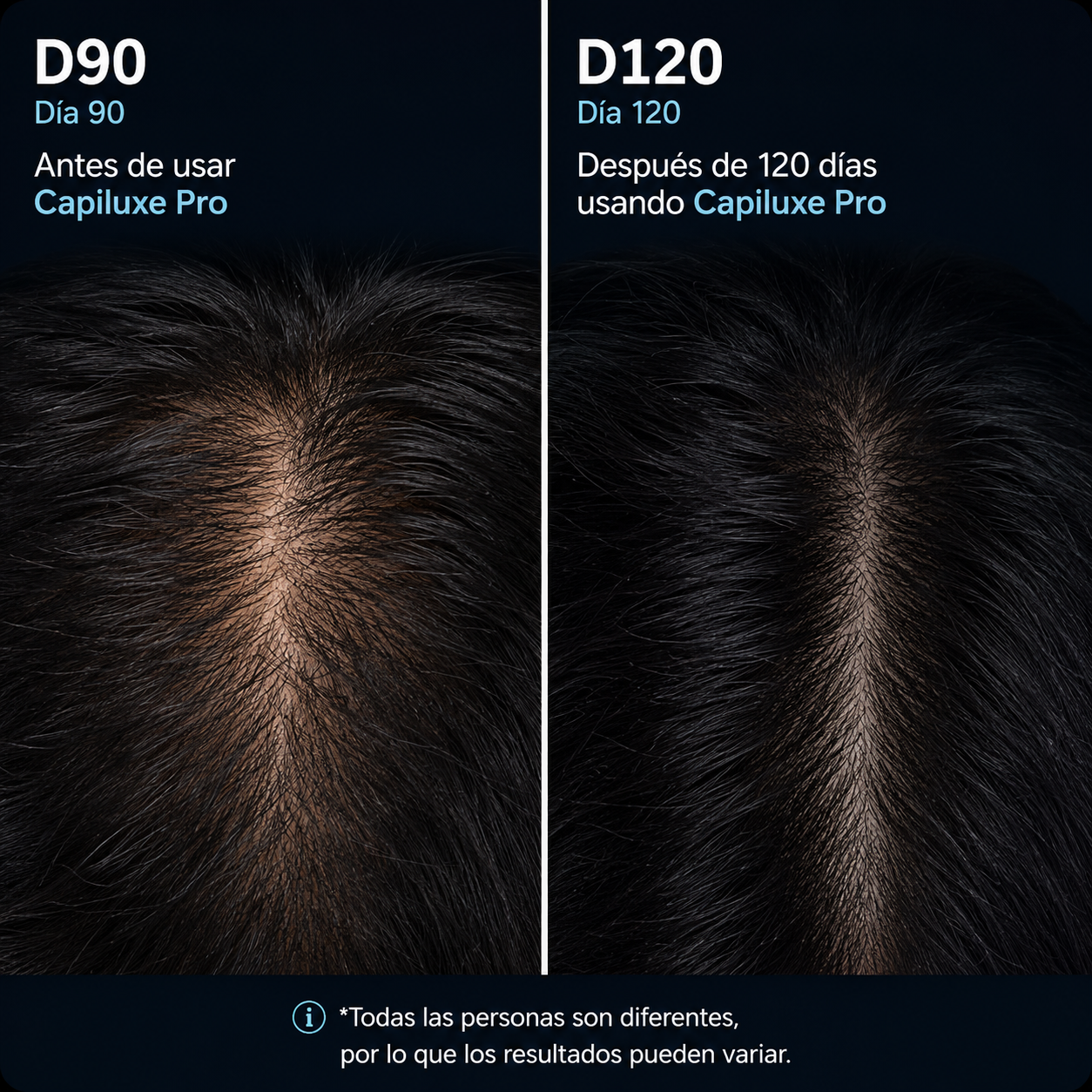 Capiluxe Pro™ | Sistema Avanzado Para Cabello Fino