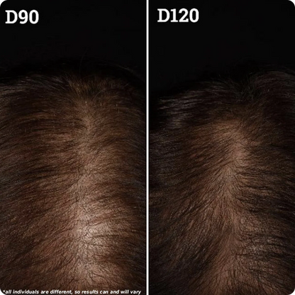 Capiluxe Pro™ | Sistema Avanzado Para Cabello Fino