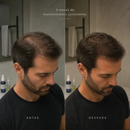 VYTA - RECUPERA TU CABELLO EN CASA